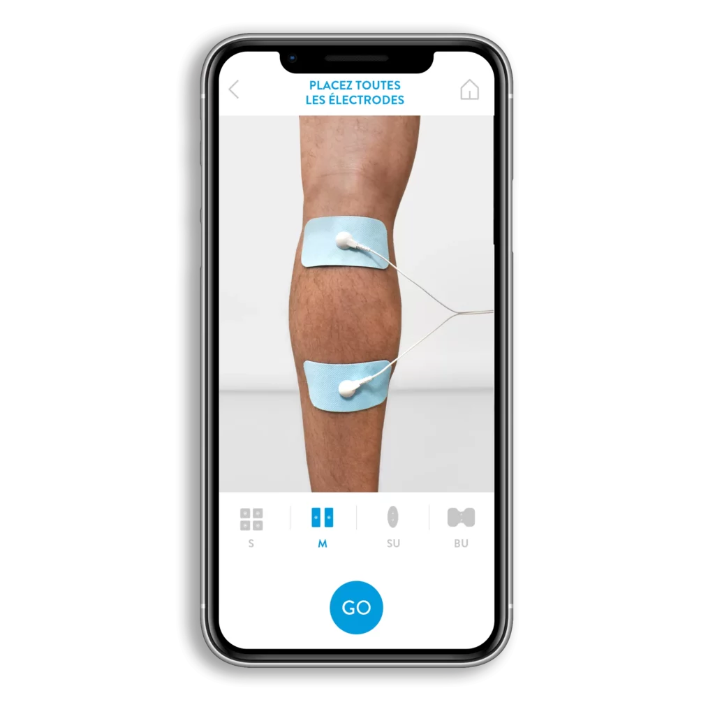 electrostimulation positionnement des électrodes pour mollet