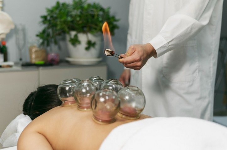 cupping therapy ventousotherapie 002