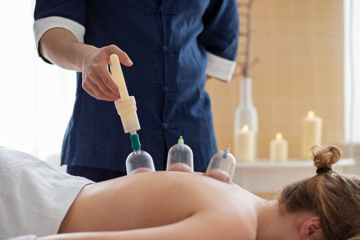 cupping therapy ventousotherapie 005
